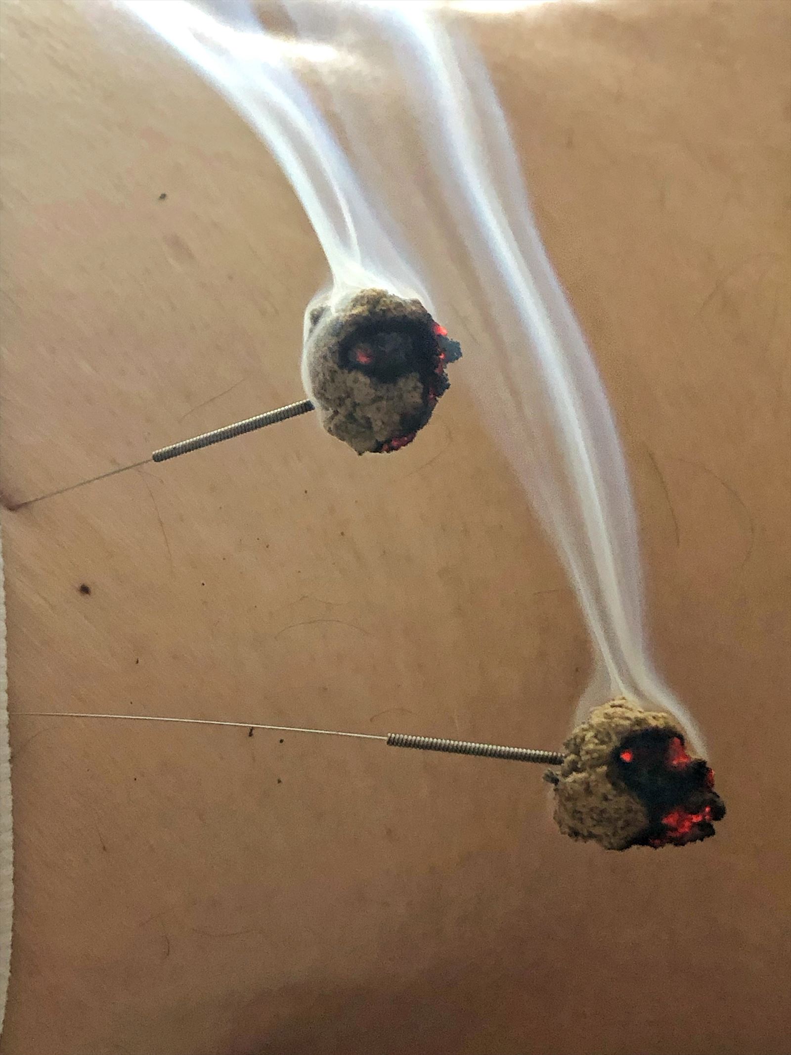 実績紹介